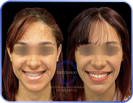 antes-e-depois-classe_3